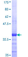 ab158006 on a 12.5% SDS-PAGE stained with Coomassie Blue.