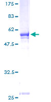 ab157998 on a 12.5% SDS-PAGE stained with Coomassie Blue.