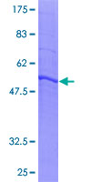 ab165766 on a 12.5% SDS-PAGE stained with Coomassie Blue.