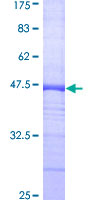 ab159755 on a 12.5% SDS-PAGE stained with Coomassie Blue.
