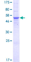 ab165832 on a 12.5% SDS-PAGE stained with Coomassie Blue.
