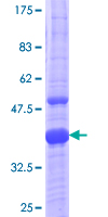 ab158661 on a 12.5% SDS-PAGE stained with Coomassie Blue.