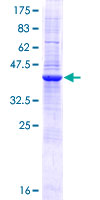 ab163366 on a 12.5% SDS-PAGE stained with Coomassie Blue.