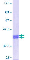 ab163367 on a 12.5% SDS-PAGE stained with Coomassie Blue.