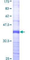 ab160907 on a 12.5% SDS-PAGE stained with Coomassie Blue.