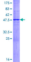 ab160790 on a 12.5% SDS-PAGE stained with Coomassie Blue.