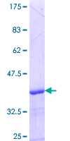 ab160791 on a 12.5% SDS-PAGE stained with Coomassie Blue.