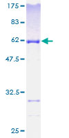 ab163914 on a 12.5% SDS-PAGE stained with Coomassie Blue.