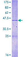 ab163903 on a 12.5% SDS-PAGE stained with Coomassie Blue.
