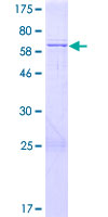 ab163909 on a 12.5% SDS-PAGE stained with Coomassie Blue.
