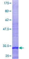 ab163908 on a 12.5% SDS-PAGE stained with Coomassie Blue.