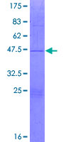 ab164611 on a 12.5% SDS-PAGE stained with Coomassie Blue.