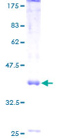 ab163541 on a 12.5% SDS-PAGE stained with Coomassie Blue.