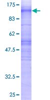 ab158049 on a 12.5% SDS-PAGE stained with Coomassie Blue.