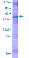 ab158050 on a 12.5% SDS-PAGE stained with Coomassie Blue.