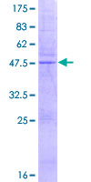 ab162515 on a 12.5% SDS-PAGE stained with Coomassie Blue.