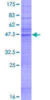 ab163811 on a 12.5% SDS-PAGE stained with Coomassie Blue.