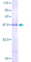ab163672 on a 12.5% SDS-PAGE stained with Coomassie Blue.