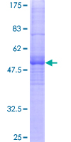 ab164420 on a 12.5% SDS-PAGE stained with Coomassie Blue.