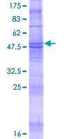 ab164421 on a 12.5% SDS-PAGE stained with Coomassie Blue.