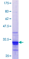 ab160395 on a 12.5% SDS-PAGE stained with Coomassie Blue.