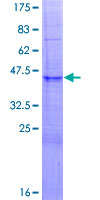 ab153255 on a 12.5% SDS-PAGE stained with Coomassie Blue.