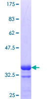 ab153256 on a 12.5% SDS-PAGE stained with Coomassie Blue.