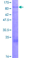 ab158921 on a 12.5% SDS-PAGE stained with Coomassie Blue.
