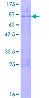 ab162411 on a 12.5% SDS-PAGE stained with Coomassie Blue.