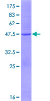 ab162152 on a 12.5% SDS-PAGE stained with Coomassie Blue.