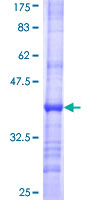 ab162153 on a 12.5% SDS-PAGE stained with Coomassie Blue.
