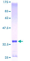 ab158923 on a 12.5% SDS-PAGE stained with Coomassie Blue.
