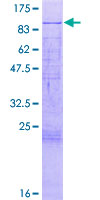 ab160388 on a 12.5% SDS-PAGE stained with Coomassie Blue.