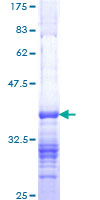 ab160389 on a 12.5% SDS-PAGE stained with Coomassie Blue.