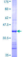 ab159919 on a 12.5% SDS-PAGE stained with Coomassie Blue.