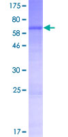 ab165337 on a 12.5% SDS-PAGE stained with Coomassie Blue.
