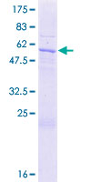 ab164894 on a 12.5% SDS-PAGE stained with Coomassie Blue.