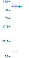 ab152954 on a 12.5% SDS-PAGE stained with Coomassie Blue.