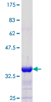ab152955 on a 12.5% SDS-PAGE stained with Coomassie Blue.
