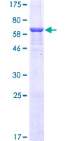 ab161832 on a 12.5% SDS-PAGE stained with Coomassie Blue.