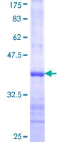 ab161833 on a 12.5% SDS-PAGE stained with Coomassie Blue.