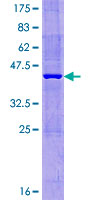 ab166542 on a 12.5% SDS-PAGE stained with Coomassie Blue.
