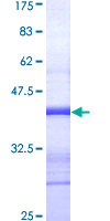 ab158931 on a 12.5% SDS-PAGE stained with Coomassie Blue.