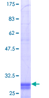 ab160178 on a 12.5% SDS-PAGE stained with Coomassie Blue.