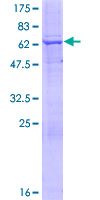 ab160179 on a 12.5% SDS-PAGE stained with Coomassie Blue.
