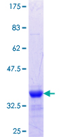 ab160180 on a 12.5% SDS-PAGE stained with Coomassie Blue.