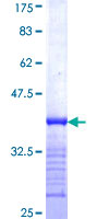 ab162776 on a 12.5% SDS-PAGE stained with Coomassie Blue.