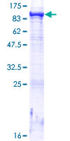 ab163146 on a 12.5% SDS-PAGE stained with Coomassie Blue.
