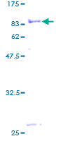 ab163949 on a 12.5% SDS-PAGE stained with Coomassie Blue.