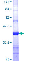ab163950 on a 12.5% SDS-PAGE stained with Coomassie Blue.